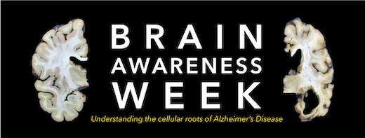 Brain Awareness Week 2022