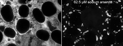 New cell line to visualize stress granules