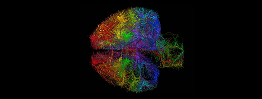 A model for how the brain stays in sync