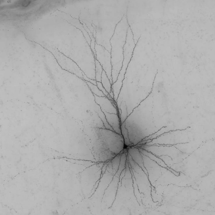 Human Spiney Neuron