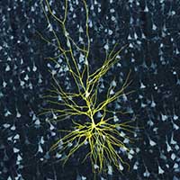 Pyramidal Neuron