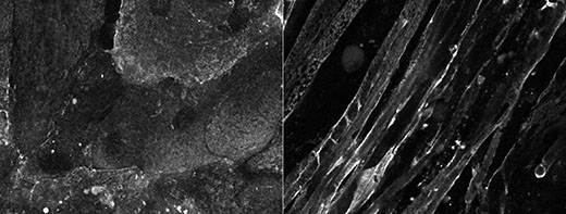 Skeletal and cardiac muscle cell lines